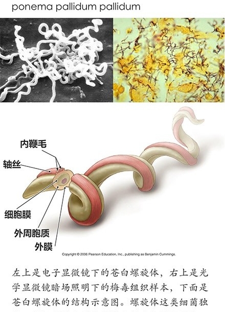 梅毒_020.jpg